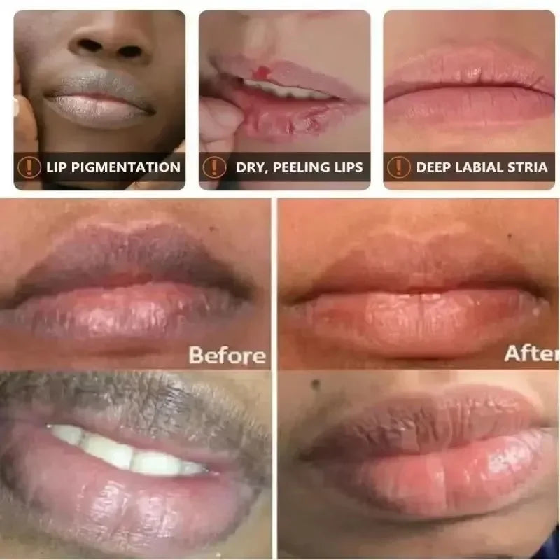 Remove Dark Lip Balm Lightening Melanin Mask Gloss Exfoliating Lip Pink Treatment Reduce Lip Lines Improve Dryness Moisturizing